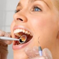 Có nên bọc răng sứ cho răng sâu