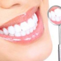 Cứu hàm răng xỉn màu bằng phương pháp bọc răng sứ