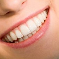 5 bước đánh răng cấy ghép implant đúng cách