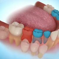 Đừng xem thường răng sữa