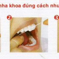 Cách đánh răng đúng giúp ngăn ngừa sâu răng