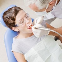 Có nên thường xuyên lấy vôi răng ( cao răng )