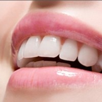 Trám răng và các phương pháp trám răng