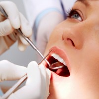 Những điều cần lưu ý trước khi đi khám răng