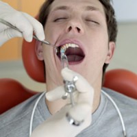 NHỮNG LƯU Ý TRƯỚC VÀ SAU KHI NHỔ RĂNG